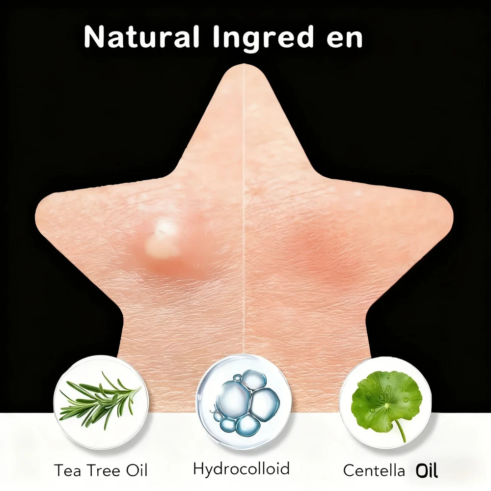 Star Shaped Hydrocolloid Pimple Patches